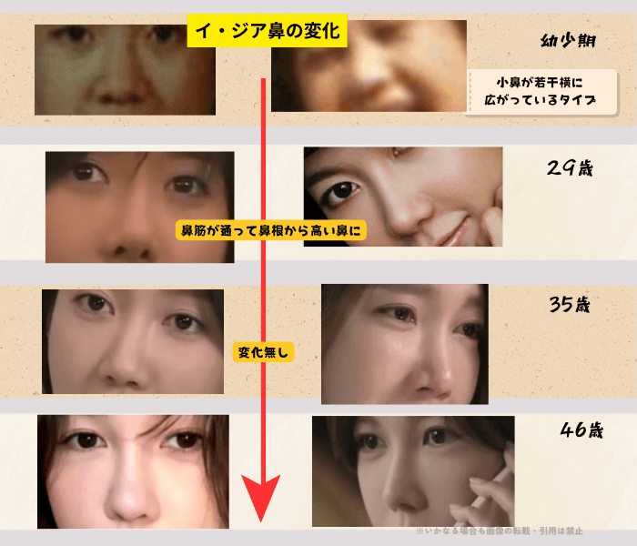 韓国女優イ・ジアの鼻の変化について時系列検証画像
以下8枚の画像

幼少期（左画像／正面　右画像／横から）
29歳（左画像／正面　右画像／横から）
35歳（左画像／正面　右画像／横から）
46歳（左画像／正面　右画像／横から）

幼少期の画像を確認すると小鼻が広めで鼻の穴が正面から見えるタイプ。
しかし29歳女優デビュー時には鼻筋が通って鼻根から高くなっていることがわかる。